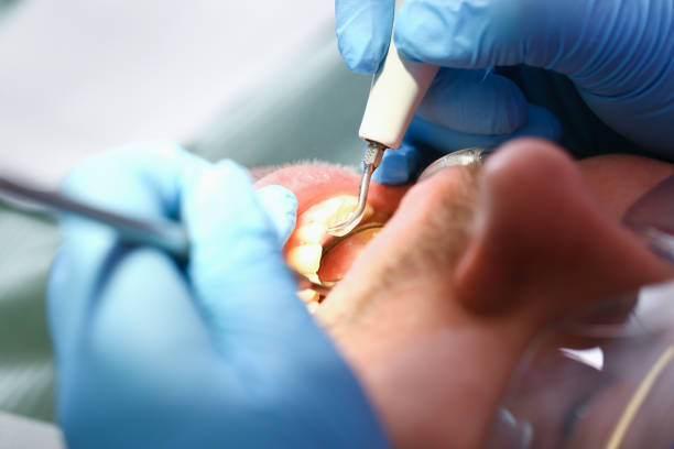 Best Emergency Treatment for Toothache in Liberty, KY
